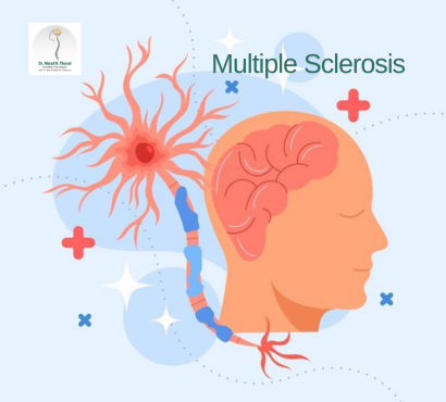 multiple-sclerosis