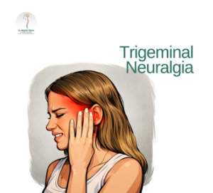 trigeminal-neuralgia