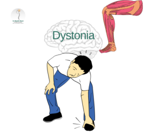 Dystonia