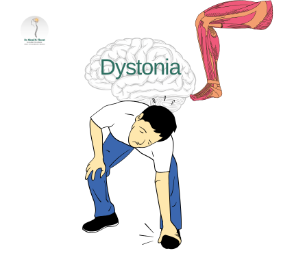 Dystonia