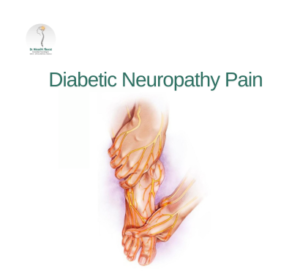 Diabetic-Neuropathy-Pain