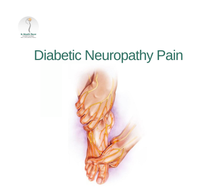 Diabetic-Neuropathy-Pain