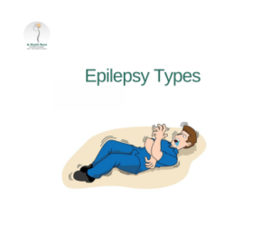 Epilepsy