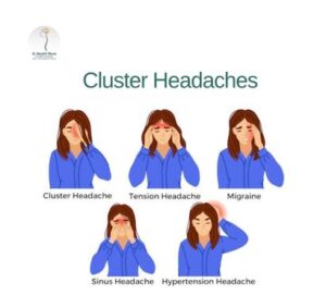 Cluster-Headaches