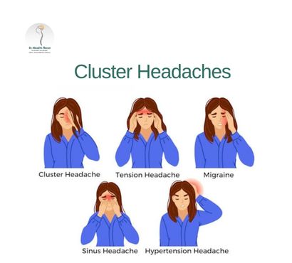 Cluster-Headaches